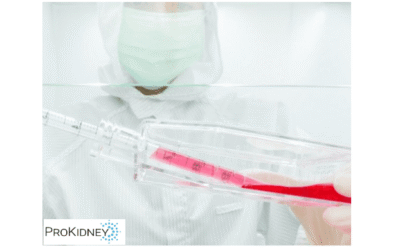 ProKidney’s stock rockets on ‘intriguing’ news, but analyst doesn’t recommend buying